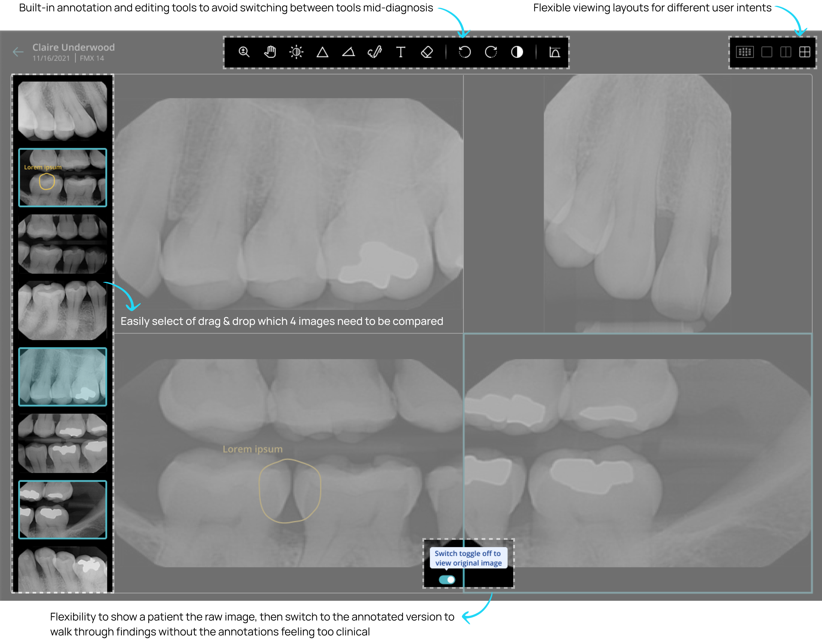 X-ray viewer: flexible layouts, annotation tools, and clean view toggle