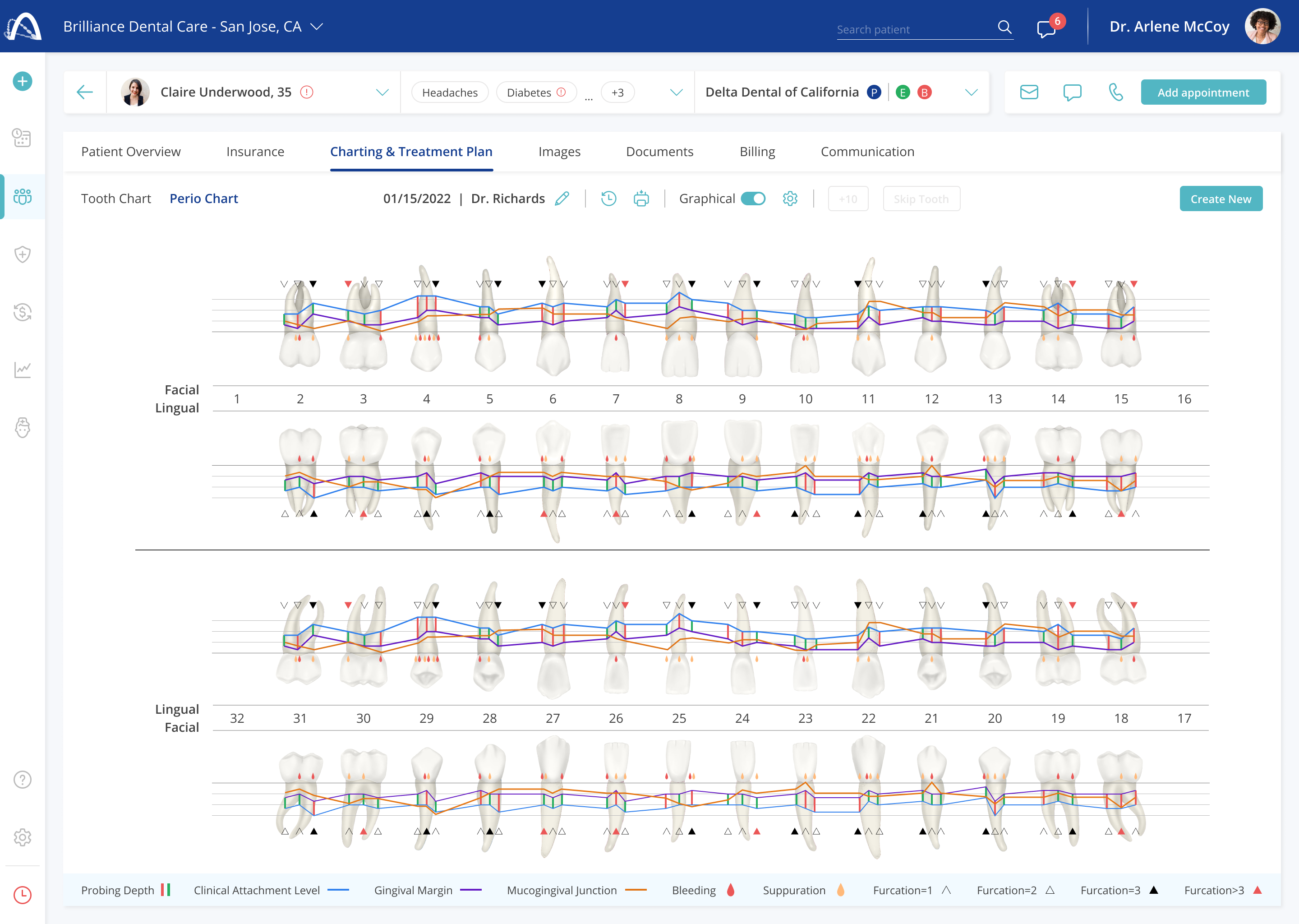 Perio charting graphical view